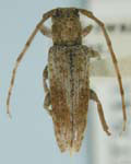  Ataxia tibialis